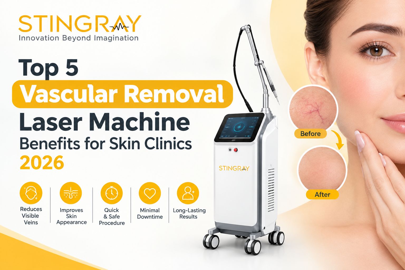 Top 5 Vascular Removal Laser Machine Benefits for Skin Clinics 2026 Top 5 Vascular Removal Laser Machine Benefits for Skin Clinics 2026